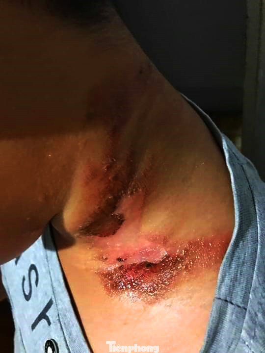 Kon Tum: Người dân lại đổ xô bắt bọ 3 sọc bán cho thương lái Trung Quốc ảnh 3