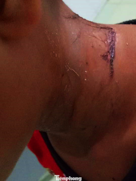 Kon Tum: Người dân lại đổ xô bắt bọ 3 sọc bán cho thương lái Trung Quốc ảnh 2