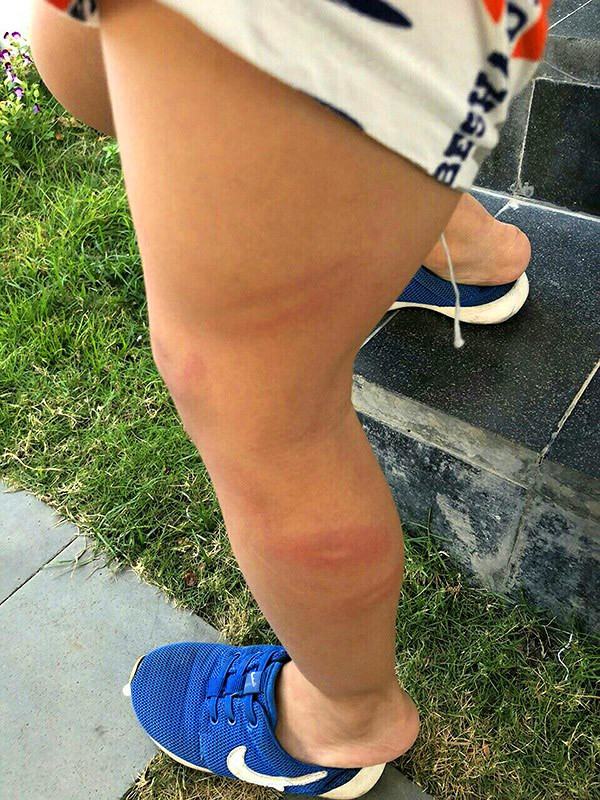 Khiển trách cô giáo lôi trẻ vào nhà vệ sinh đánh lằn chân ảnh 1