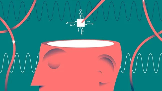 Cấy chip Neuralink vào trong não người để hỗ trợ những người liệt nửa người Cấy chip Neuralink vào trong não người để hỗ trợ những người liệt nửa người