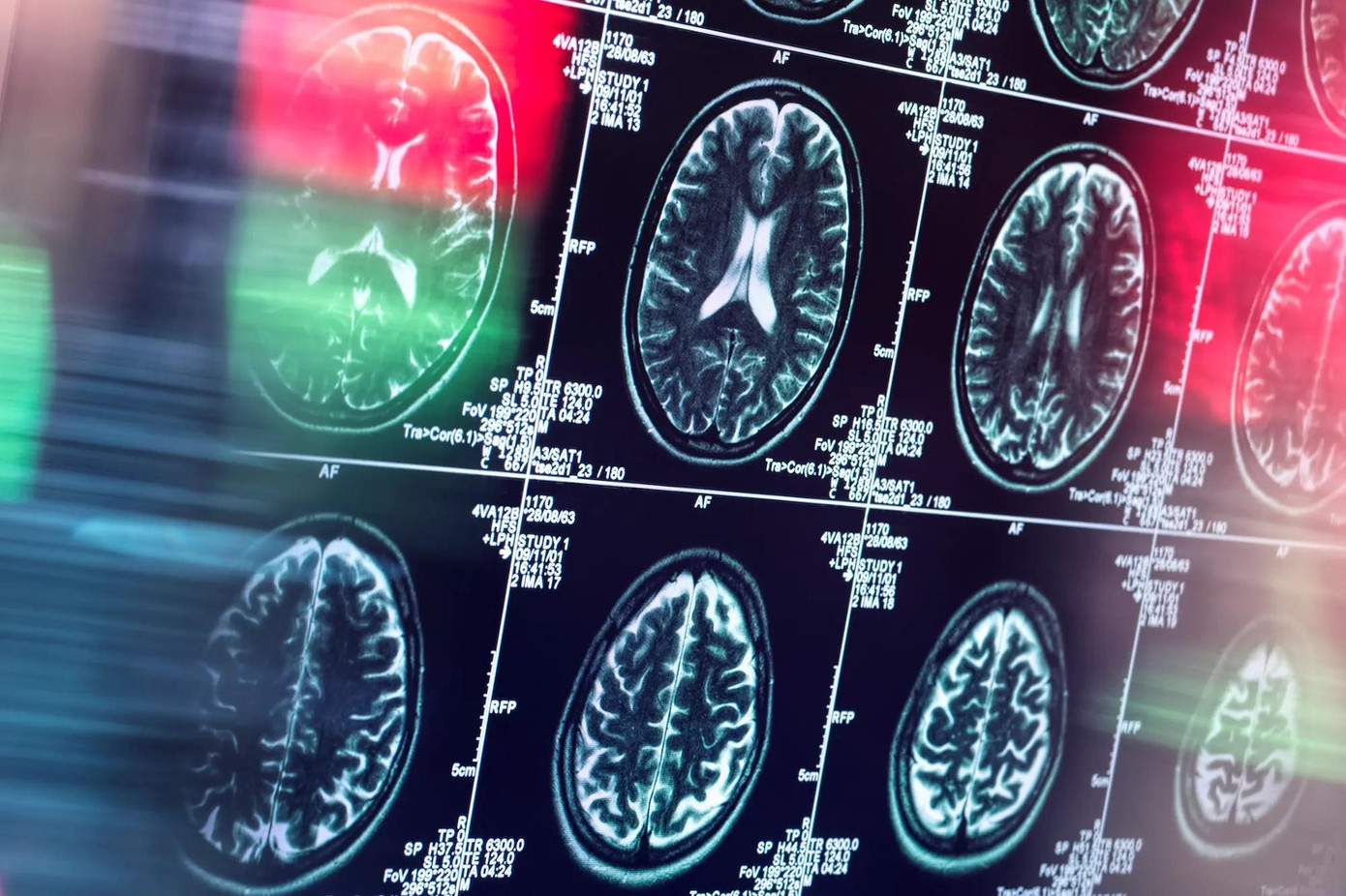 Nghiên cứu về não bộ của những người từ 40-50 tuổi cho thấy sự suy thoái chức năng não bộ theo thời gian. Nghiên cứu về não bộ của những người từ 40-50 tuổi cho thấy sự suy thoái chức năng não bộ theo thời gian.