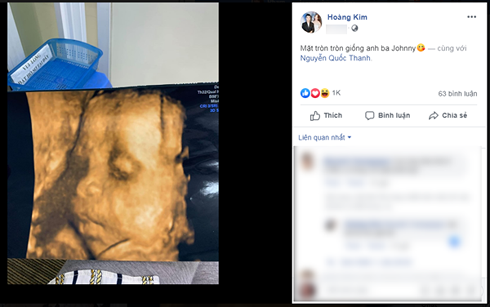 Showbiz 10/8: Phản ứng của Trấn Thành khi thấy Hari Won mặc bikini ảnh 3