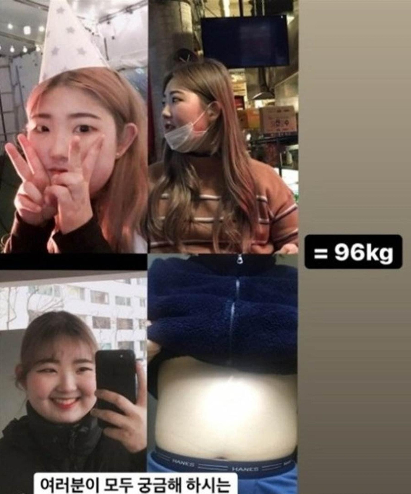 Choi Jun Hee chia sẻ cô từng có giai đoạn trầm cảm phải vào bệnh viện điều trị hơn một năm. Bên cạnh đó, việc mắc bệnh Lupus ban đỏ khiến cân nặng của Choi Jun Hee tăng không kiểm soát. Có thời điểm cô nặng tới 96 kg. Vì thân hình kém thon gọn, Choi Jun Hee càng thiếu tự tin, khiến bệnh trầm cảm nặng hơn. Vòng tuần hoàn đó dường như khiến thiếu nữ ở độ tuổi 17 gục ngã.