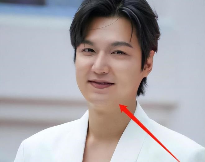 Nam diễn viên được cho là có khuôn mặt dễ sưng phù.