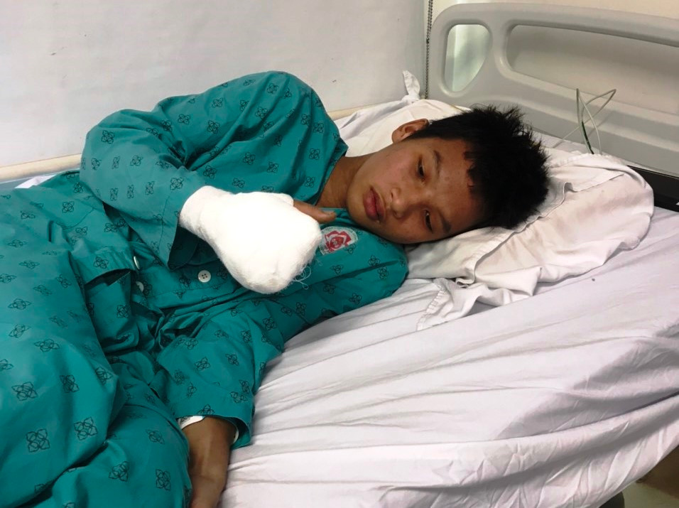 Đậu Đức Thông bị mất gần như đôi bàn tay sau tai nạn lao động. Đậu Đức Thông bị mất gần như đôi bàn tay sau tai nạn lao động.