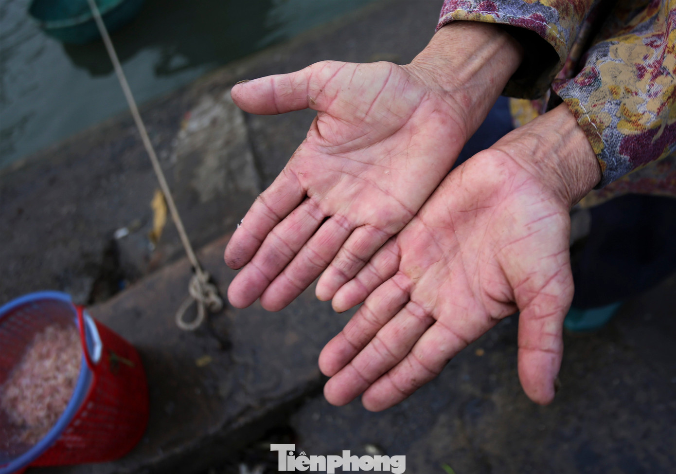 Cường độ làm việc thường xuyên, tiếp xúc với cá tươi và nước biển khiến làn da tay của họ săn lại, nhiều người bị bong tróc da bởi vị mặn của biển.