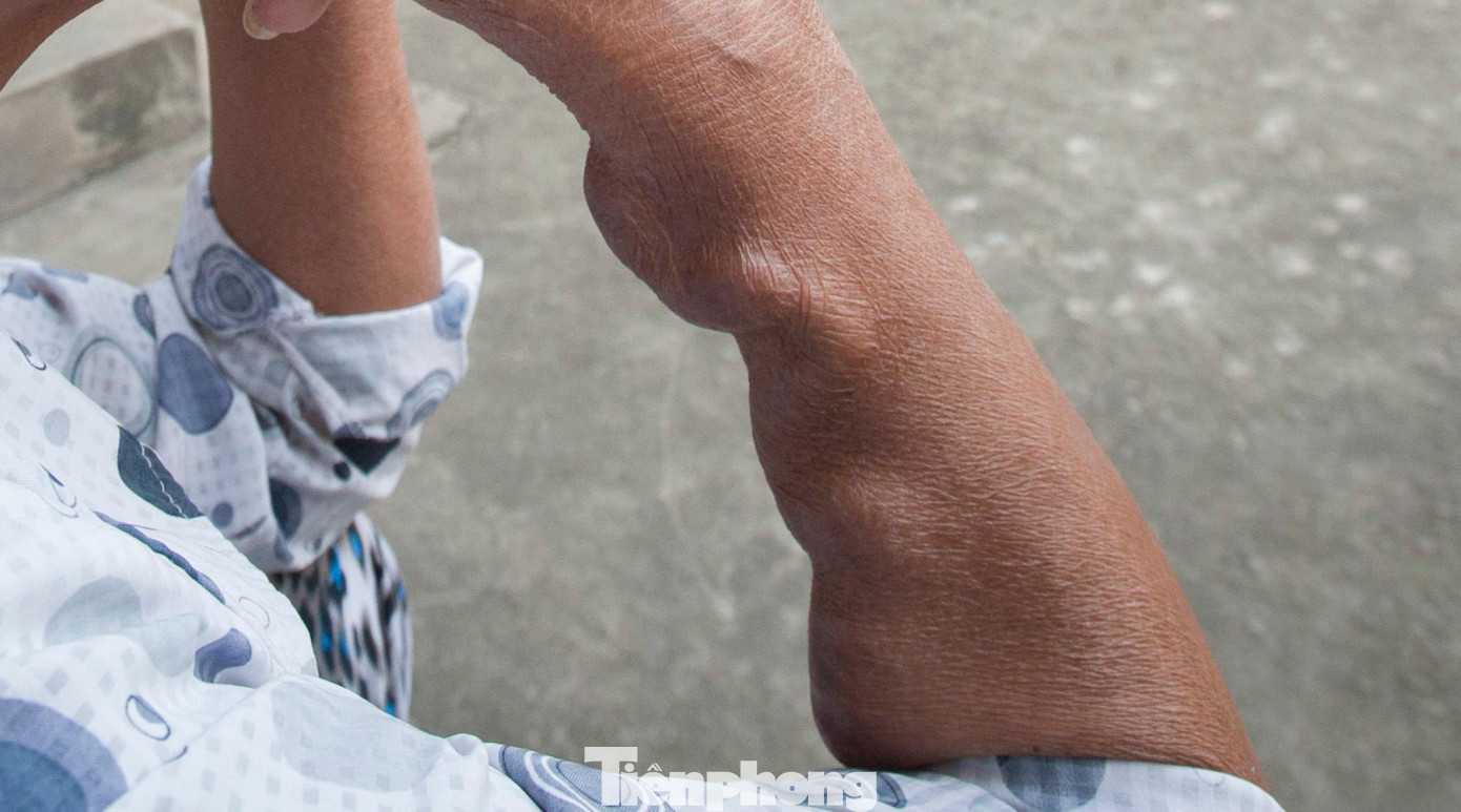 Hoàn cảnh thêm éo le hơn khi những nguồn thu ít ỏi về việc làm thêm như nhặt ve chai, chạy xe ôm bị đứt đoạn trong đại dịch.