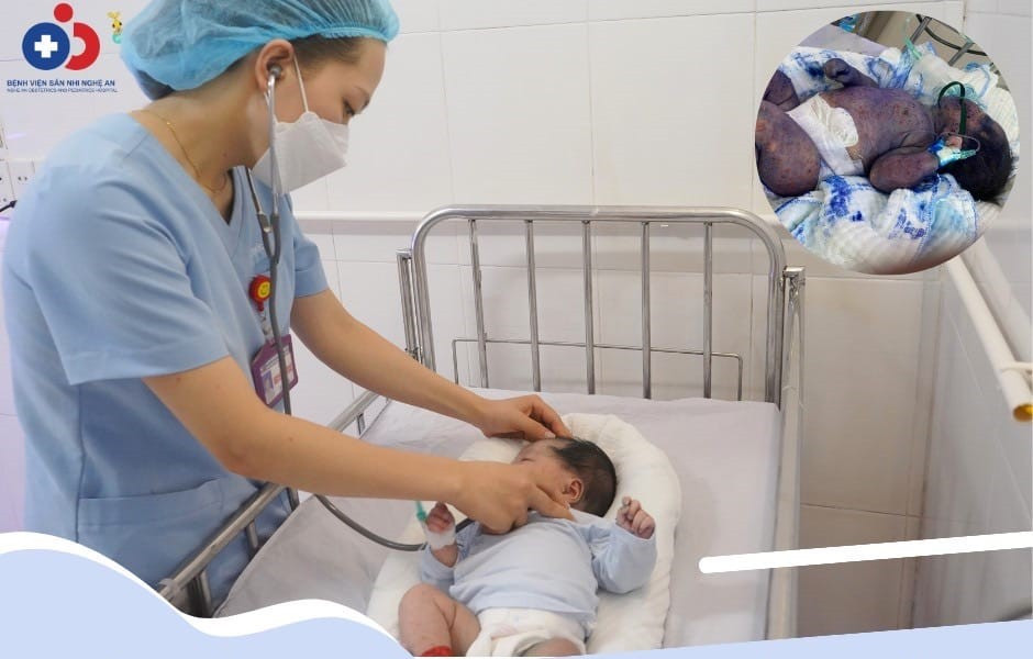 Hai bé sơ sinh bị thủy đậu toàn thân được cứu sống. Ảnh Bệnh viện cung cấp. Hai bé sơ sinh bị thủy đậu toàn thân được cứu sống. Ảnh Bệnh viện cung cấp.