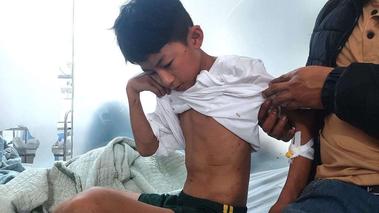 Nhật bị nhiều mảnh vỡ văng vào người, bụng. Nhật bị nhiều mảnh vỡ văng vào người, bụng.