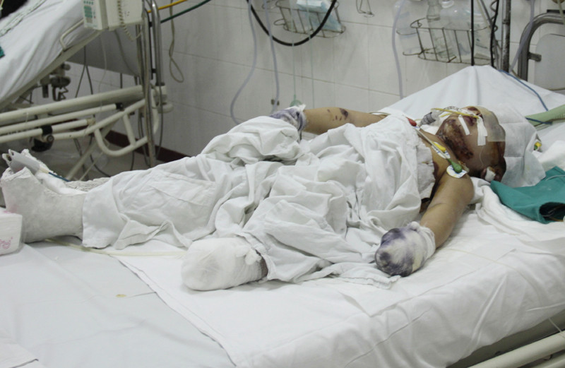 Cháu Nguyễn Khánh Vân khi được điều trị tại Bệnh viện Việt Đức hôm 6-12