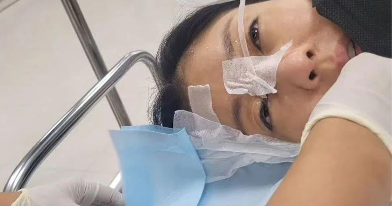 Ca sĩ Lee Ji Hyun chia sẻ hình ảnh bị tổn thương giác mạc. Ảnh: IG.