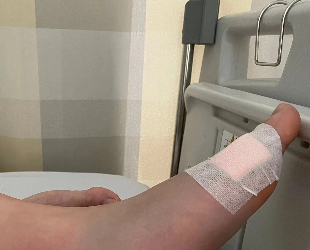 Ảnh do Lim Kang Seong đăng tải vào thời điểm xảy ra tai nạn do rắn cắn. Ảnh: IG.