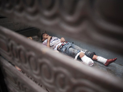 Cậu bé ở thành phố Aleppo bị thương hôm 11-10 do bom rơi đạn lạc. Ảnh: AP