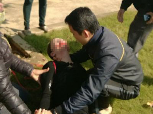 Sau khi treo cổ lên cành cây nhưng bất thành, chị Lan được người dân xung quanh chạy đến sơ cứu, đưa đi bệnh viện. Bài viết: http://news.zing.vn/Nguoi-dep-treo-co-tu-tu-chi-la-man-kich-post378934.html#home_featured.noibat Nguồn Zing News 