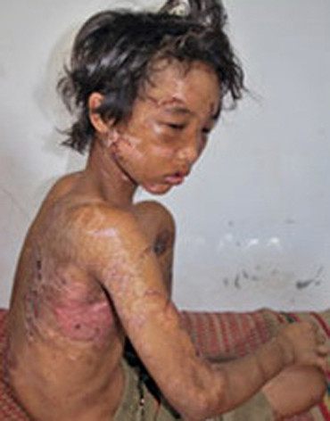 Hào Anh: Từ đứa trẻ bị 'bạo hành' đến 'ngược đãi' cha mẹ ảnh 1