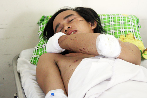 Giây phút kinh hoàng lò nấu thép 1.500 độ C phát nổ ảnh 3