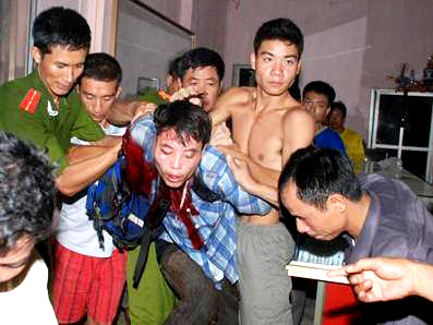 Tên cướp bị bắt nhưng bé Vy phải vĩnh viễn ra đi