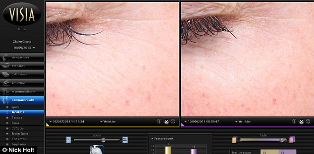 Nếp nhăn biến mất sau 30 ngày dùng Nivea (ảnh bên trái là ảnh sau khi dùng)