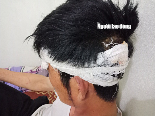 Tài xế taxi Mai Linh khẳng định bị người có xe Mercedes đánh dã man ảnh 1