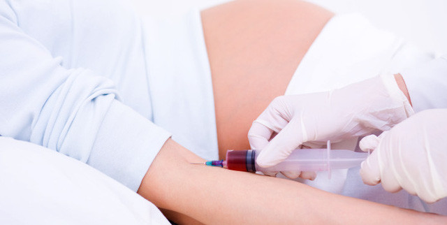 Có đến 3 NST số 21 - ở người mắc hội chứng Down