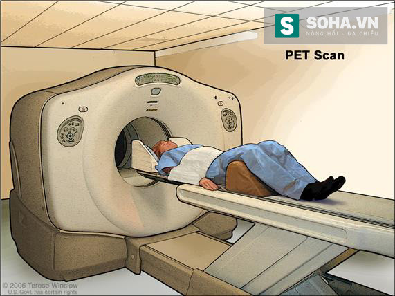 Có thể dùng PET Scan để phát hiện sớm ung thư không? ảnh 1