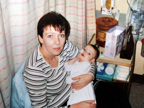 Abbie khi phải trải qua phẫu thuật tim lúc em mới 13 tuần tuổi. Ảnh:North News & Pictures Ltd