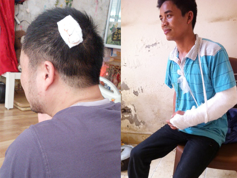 Ông Đàm Văn Long - Chủ tịch HĐQT Công ty Tập đoàn Phương Bắc và lái máy Nguyễn Trung Thành với thương tích trên người. Ảnh: TN