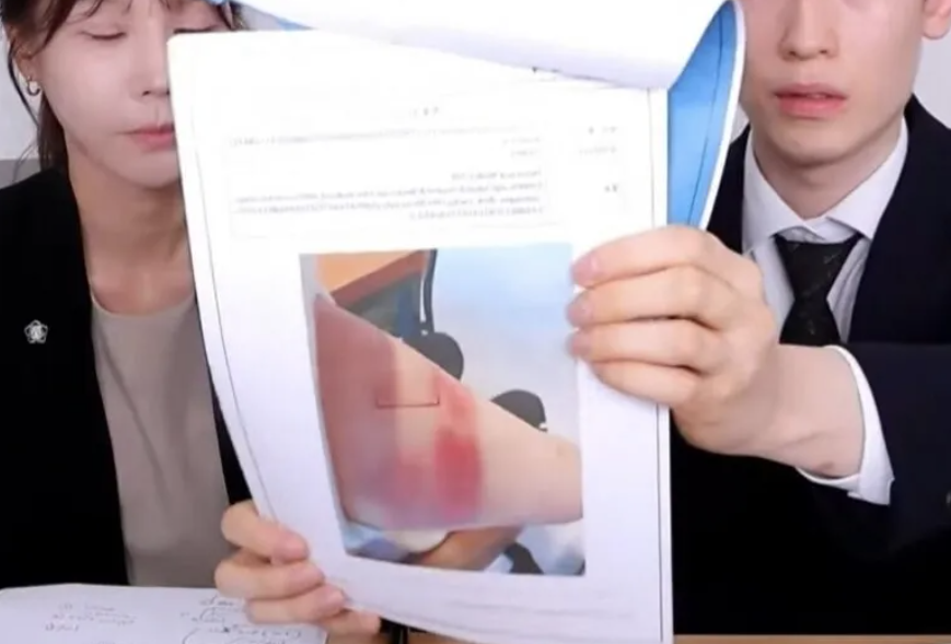 Phiên livestream của Tzuyang có sự xuất hiện của luật sư, công bố bằng chứng về những thương tổn thể xác mà A gây ra cho Tzuyang.