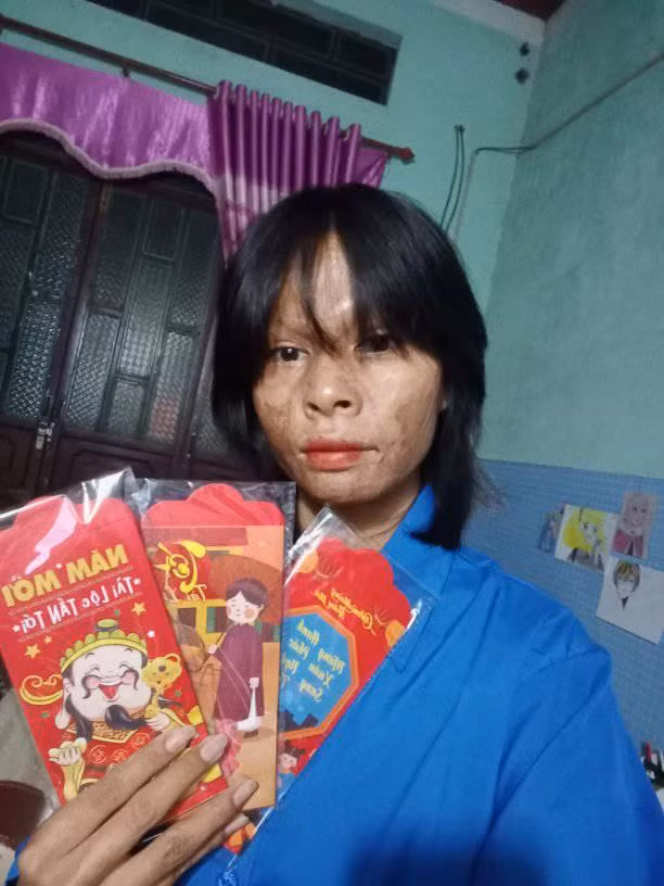 Thoan vẫn luôn lạc quan, truyền năng lượng tích cực đến mọi người.