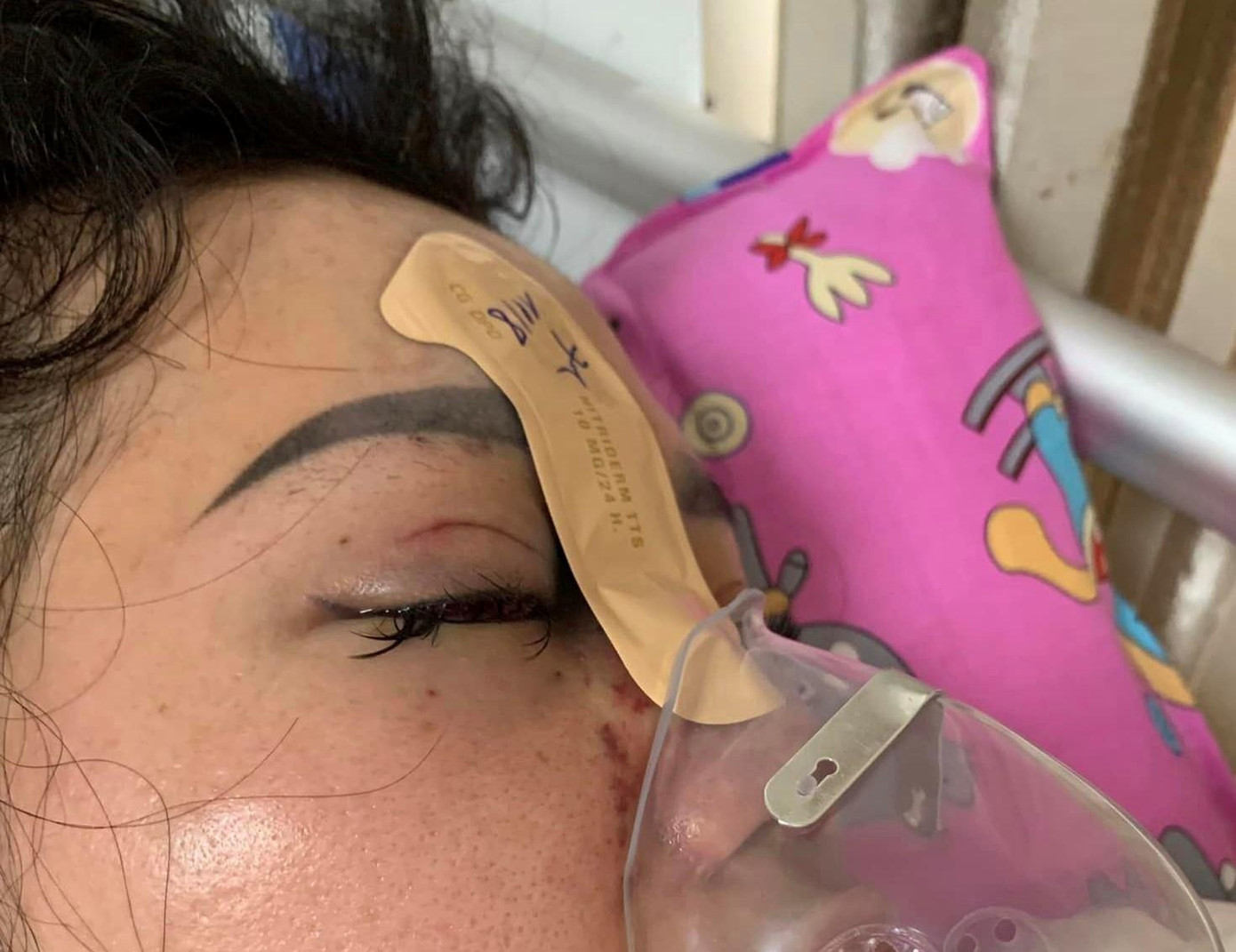 Chị V. trong quá trình nằm viện điều trị. Ảnh: Gia đình cung cấp.