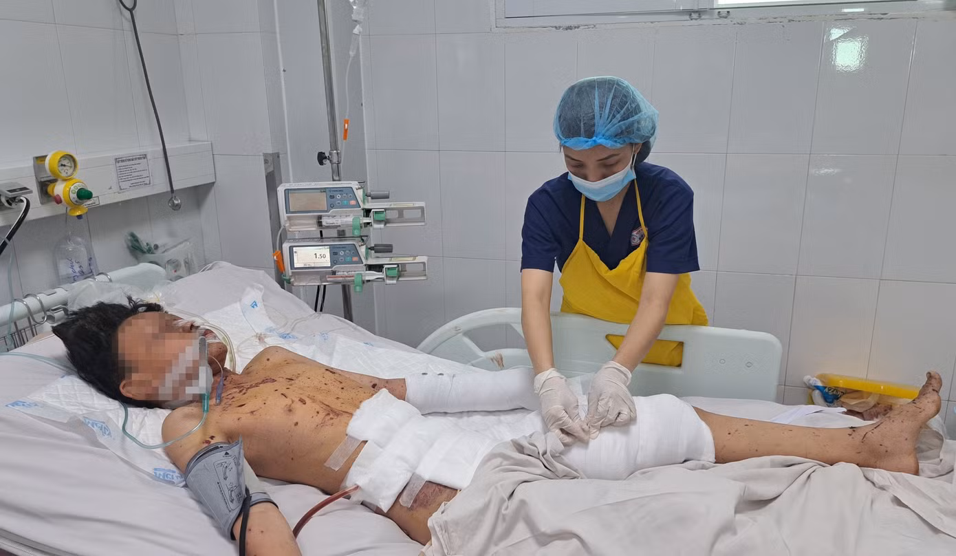 Bé trai bị thủng bụng, nát tay do chơi pháo. Bé trai bị thủng bụng, nát tay do chơi pháo.