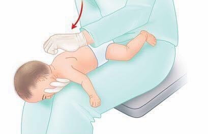 Trang bị kỹ năng xử lý trẻ bị ho, sặc rất cần thiết đối với người trông giữ trẻ. Ảnh minh hoạ.