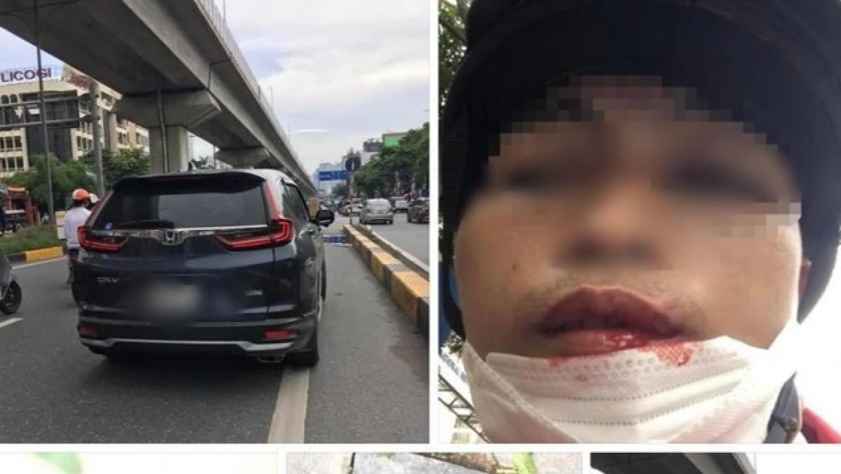 Nạn nhân H.Q.N và chiếc xe ô tô CRV trong vụ việc Nạn nhân H.Q.N và chiếc xe ô tô CRV trong vụ việc