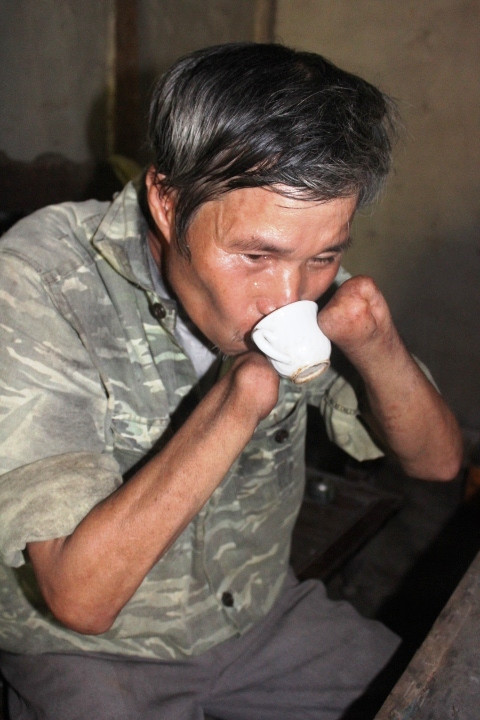 Trong số họ, có nhiều người đã từng tham gia đội quân tìm sắt vụn, khi chạm phải mìn phát nổ, một phần thân thể của họ đã không còn