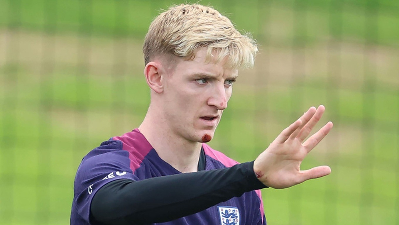 Anthony Gordon (trái) gặp tai nạn hy hữu và Phil Foden phải bay về Anh gấp vì bạn gái sinh con thứ ba. Ảnh: Getty. Anthony Gordon (trái) gặp tai nạn hy hữu và Phil Foden phải bay về Anh gấp vì bạn gái sinh con thứ ba. Ảnh: Getty.