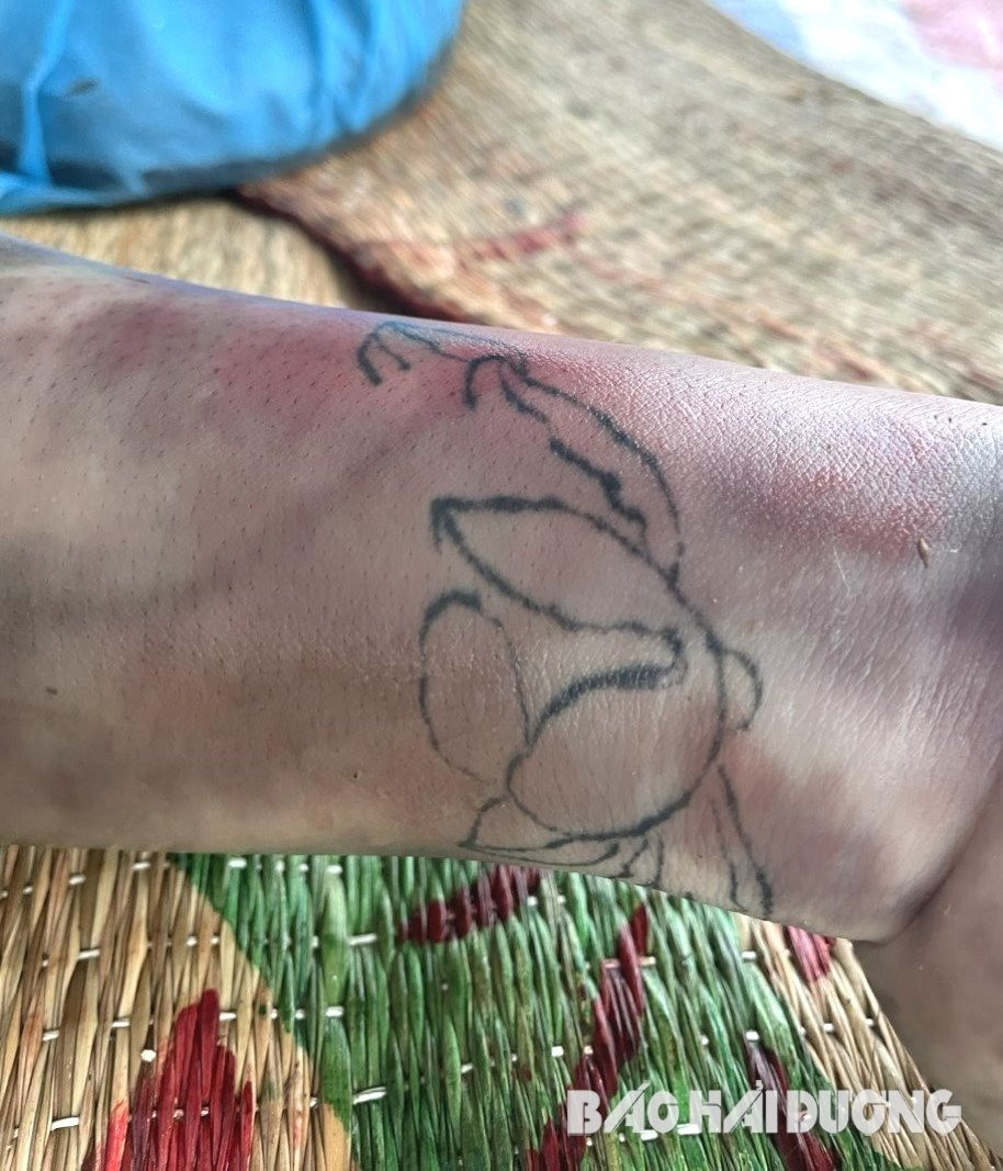 Hình xăm trên tay nạn nhân. Hình xăm trên tay nạn nhân.