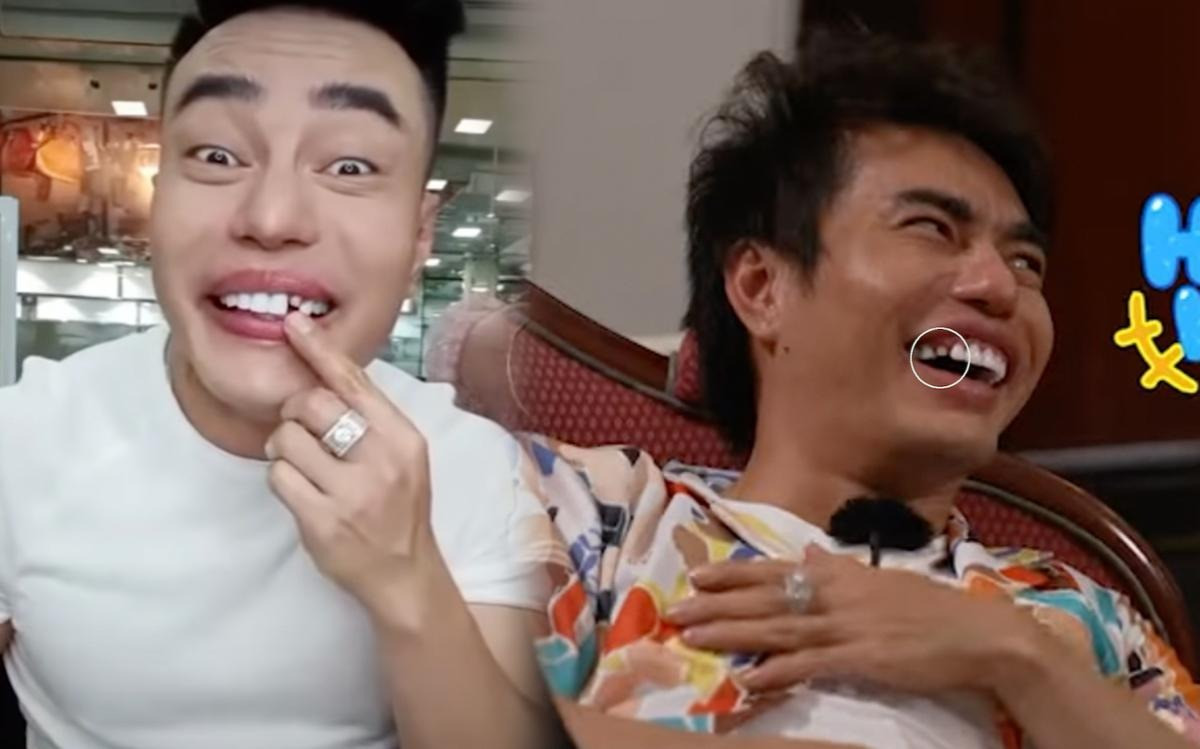 Lê Dương Bảo Lâm liên tục rơi răng sứ khi xuất hiện trên show. Lê Dương Bảo Lâm liên tục rơi răng sứ khi xuất hiện trên show.