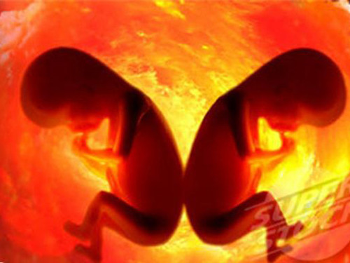 Bào thai có trong bụng bé trai từ lúc mới sinh ra. Ảnh minh họa