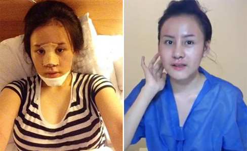 Và khuôn mặt nham nhở đáng sợ hiện tại trong quá trình phẫu thuật