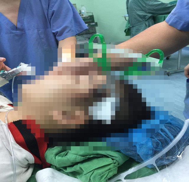 Nô đùa cùng bạn trong lớp, bé gái 10 tuổi bị kéo đâm sâu vào đầu ảnh 1