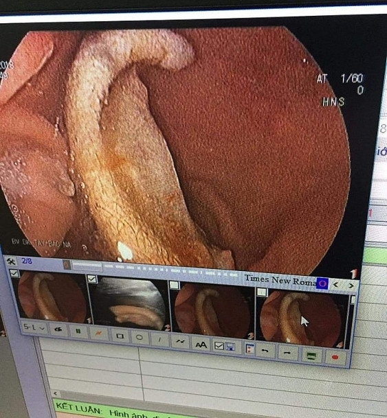 Nghi vấn nam sinh 'phê cỏ Mỹ' cắn đứt tai bạn ảnh 1