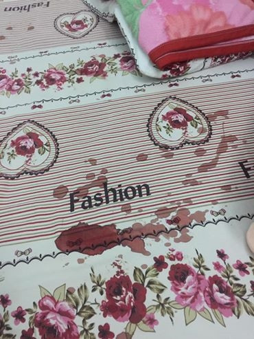 Mẹ hốt hoảng thấy con bị chuột cắn nát tay khi đang ngủ ảnh 1