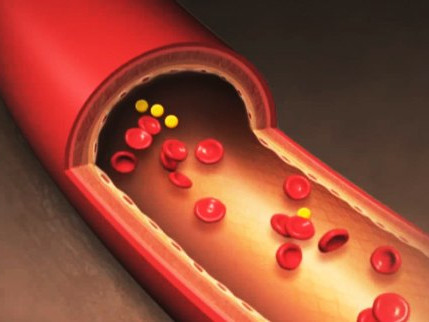 OTIV chứa Anthocyanin, Pterostilbene… có tác dụng chống gốc tự do, khơi thông dòng máu lên não, giúp phòng ngừa và hạn chế rối loạn giấc ngủ