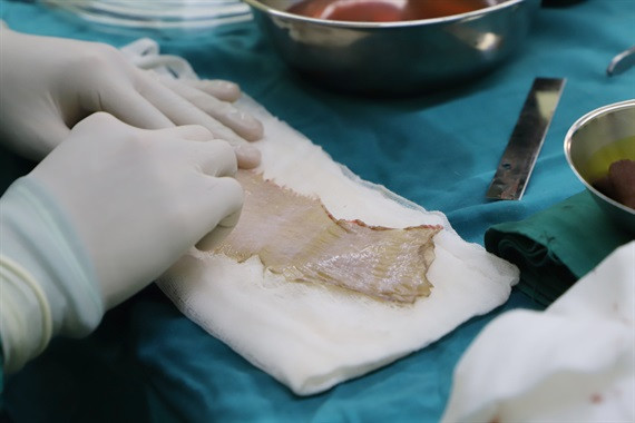 Bệnh viện Sài Gòn cứu cô gái bị liên cầu khuẩn lợn do xước tay ảnh 1