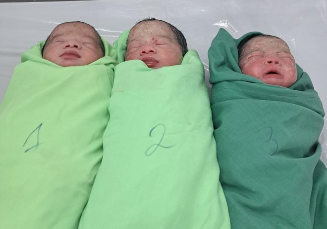 Sức khỏe của 3 bé sơ sinh ổn định sau khi phẫu thuật sinh non Sức khỏe của 3 bé sơ sinh ổn định sau khi phẫu thuật sinh non