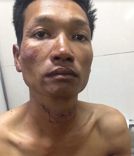 Đốt nhà, dìm vợ chết trong bể nước do cuồng ghen ảnh 1