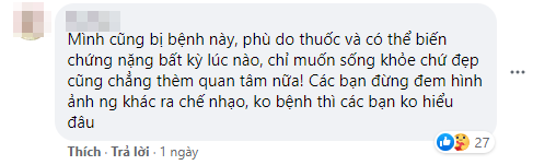 Người hâm mộ giải thích và yêu cầu netizen ngưng miệt thị ngoại hình của Selena.