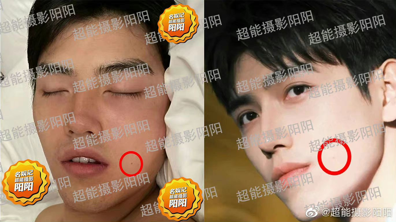 Blogger so sánh những nốt ruồi trên mặt của người đàn ông trong ảnh giống với Trần Phi Vũ. Blogger so sánh những nốt ruồi trên mặt của người đàn ông trong ảnh giống với Trần Phi Vũ.