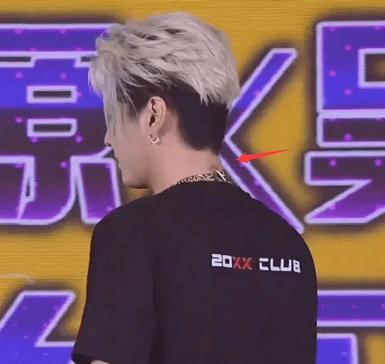 Vết ban đỏ sau gáy Ngô Diệc Phàm khiến cư dân mạng liên tưởng đến vết săng giang mai. Vết ban đỏ sau gáy Ngô Diệc Phàm khiến cư dân mạng liên tưởng đến vết săng giang mai.