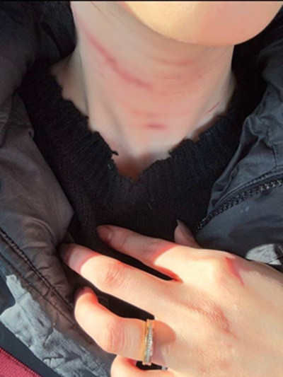 Bức ảnh Sae Ron gửi cho bạn trai cũ khi kể về cuộc sống hôn nhân kinh khủng của mình. Cô cho biết mình không thể ly hôn vì chồng đe dọa phát tán tin nhắn, hack SNS của cô. Bức ảnh Sae Ron gửi cho bạn trai cũ khi kể về cuộc sống hôn nhân kinh khủng của mình. Cô cho biết mình không thể ly hôn vì chồng đe dọa phát tán tin nhắn, hack SNS của cô.